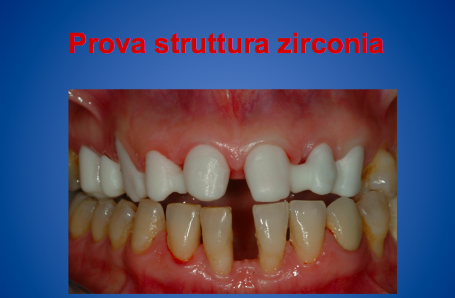 Schermata 2015-09-11 alle 11.37.36